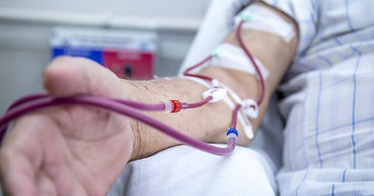 Imagem de acesso vascular em contexto de hemodiálise para página de fístula arteriovenosa.