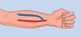 Tratamento de Varizes por Laser - imagem clínica